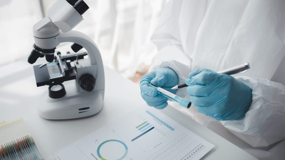 Lab practitioner working on chemical research for chemical reactions, does a chemical experiment and examines a patient's blood sample. Medicine and research concept.